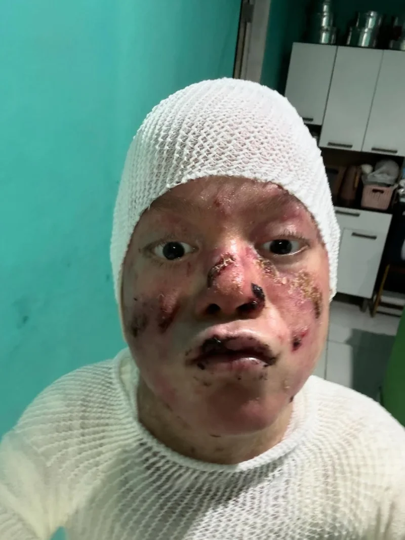 AJUDE O GILBERTO — Cada dia é precioso ⏳